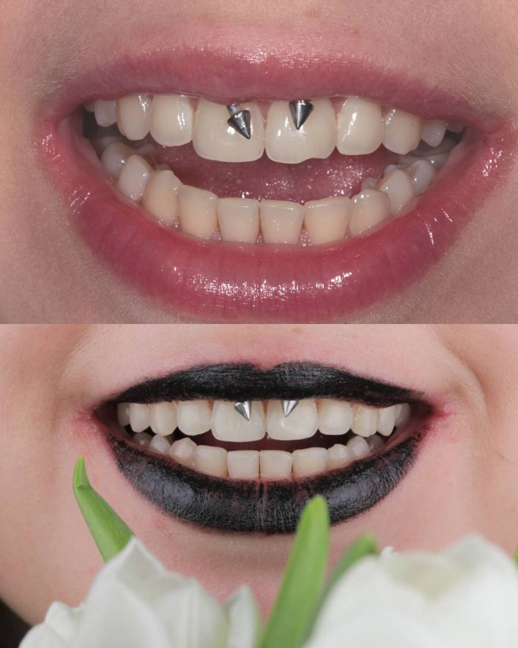 Гавриленко И.С. , Художественная реставрация одного зуба 
