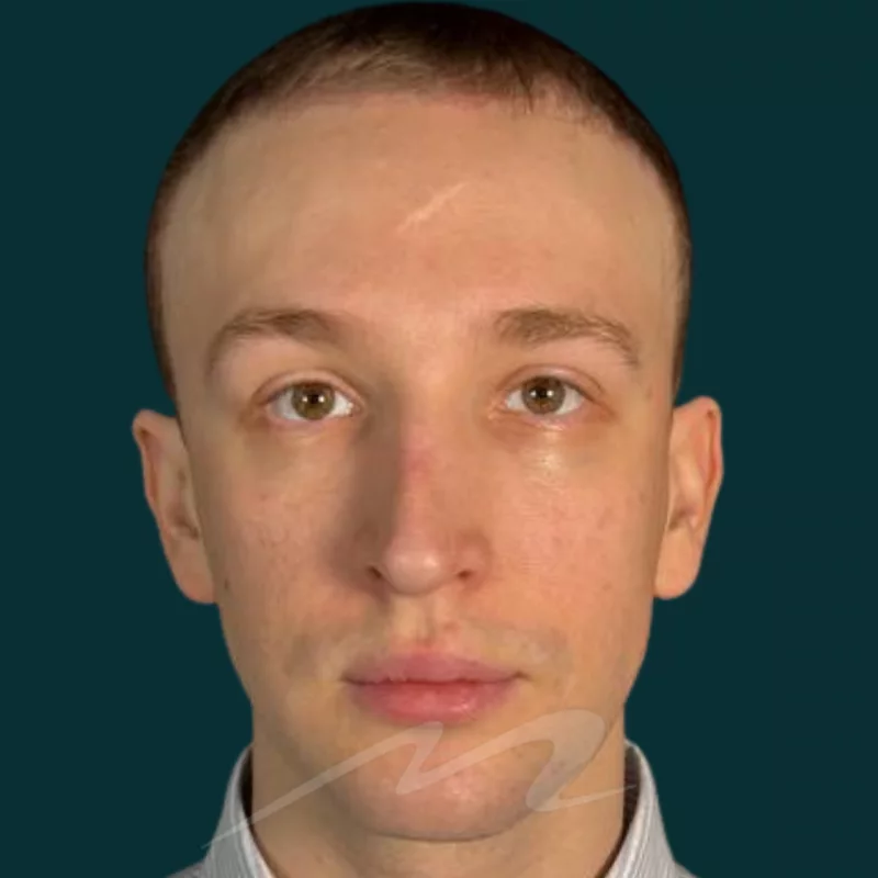 Волков пьезо 101