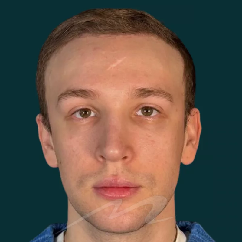 Волков пьезо 101